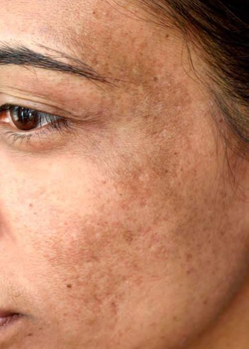 83835aaaffc5564b67113467ea555afb