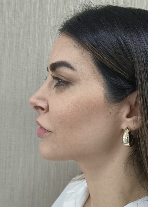 IMG_20250828_164250649_HDR