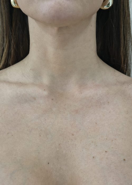 IMG_20250828_164530773_HDR