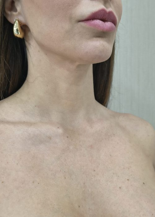 IMG_20250828_164536115_HDR